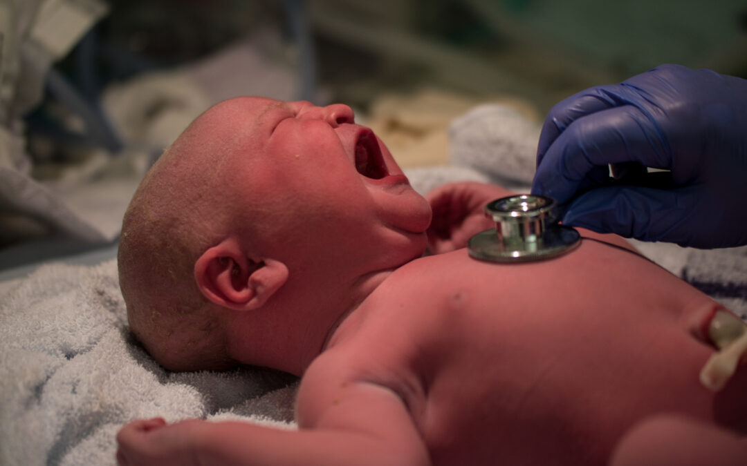 Brachial Plexus Birth Injury – Erb’s Palsy