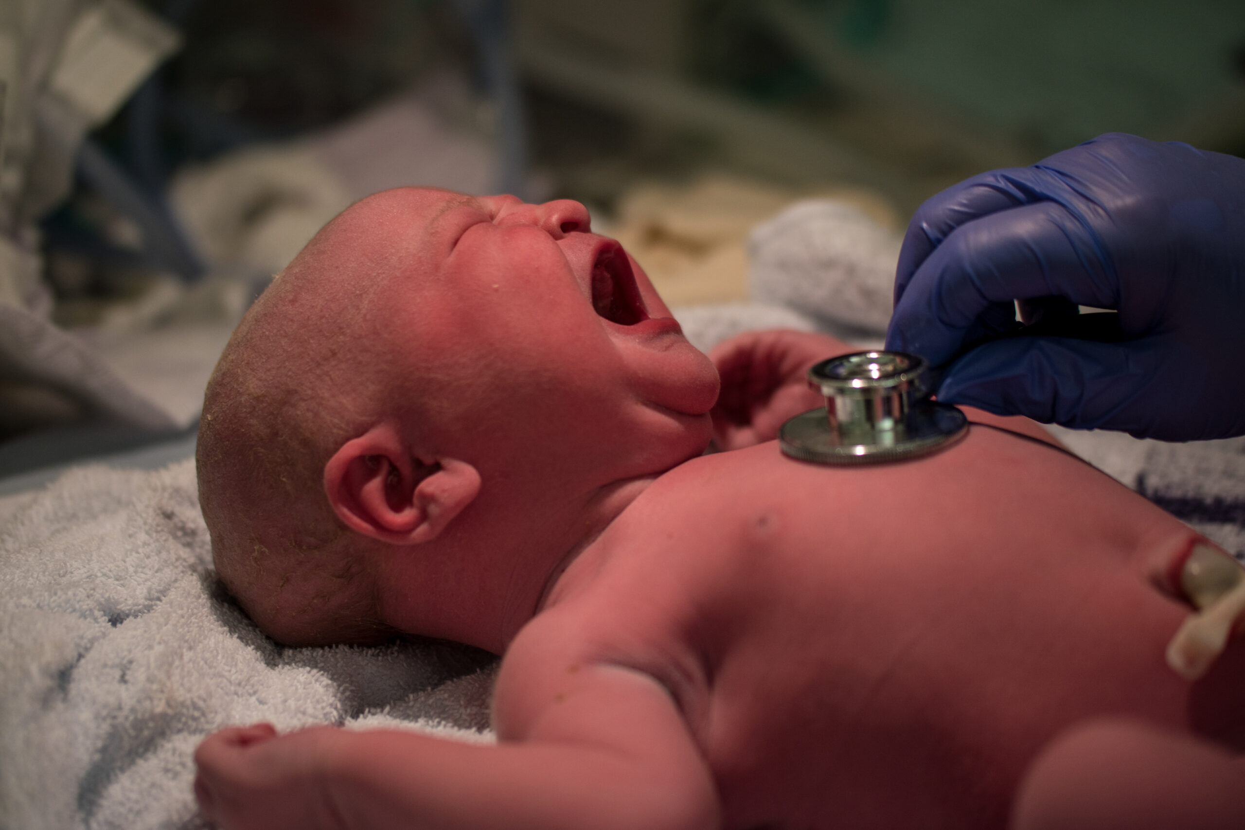 Crying newborn baby being checked with a stethoscope