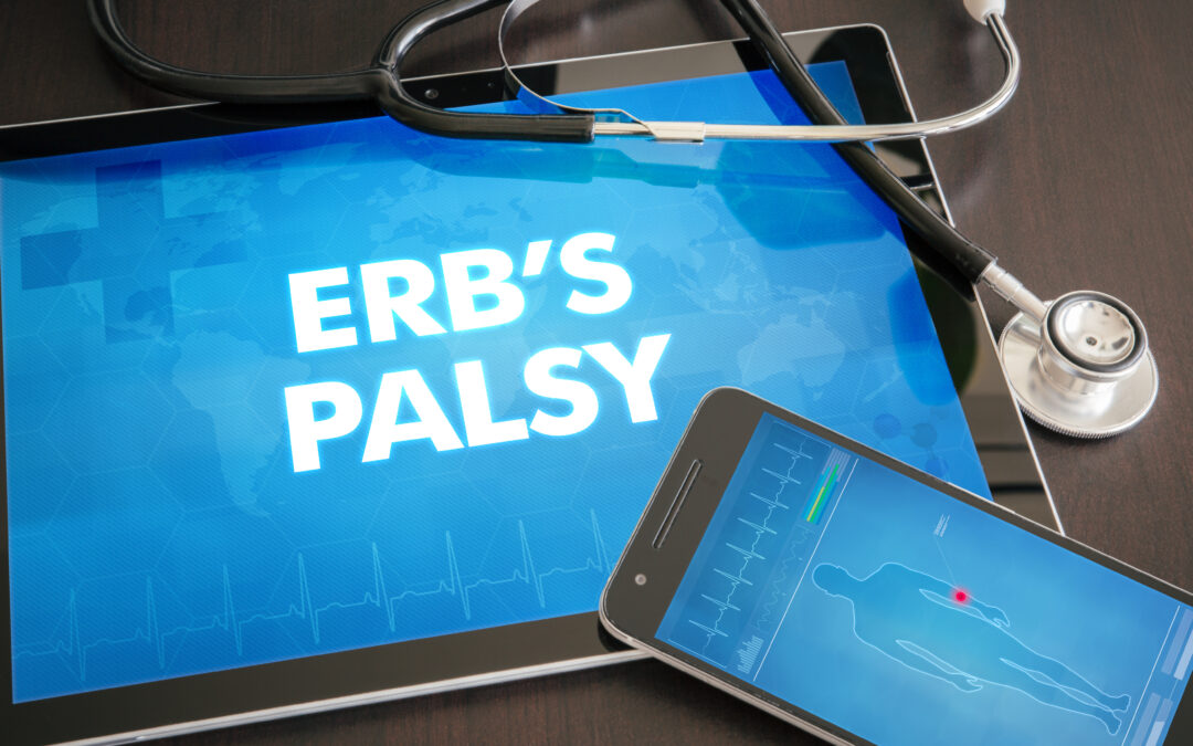 Erb’s Palsy Birth Injury