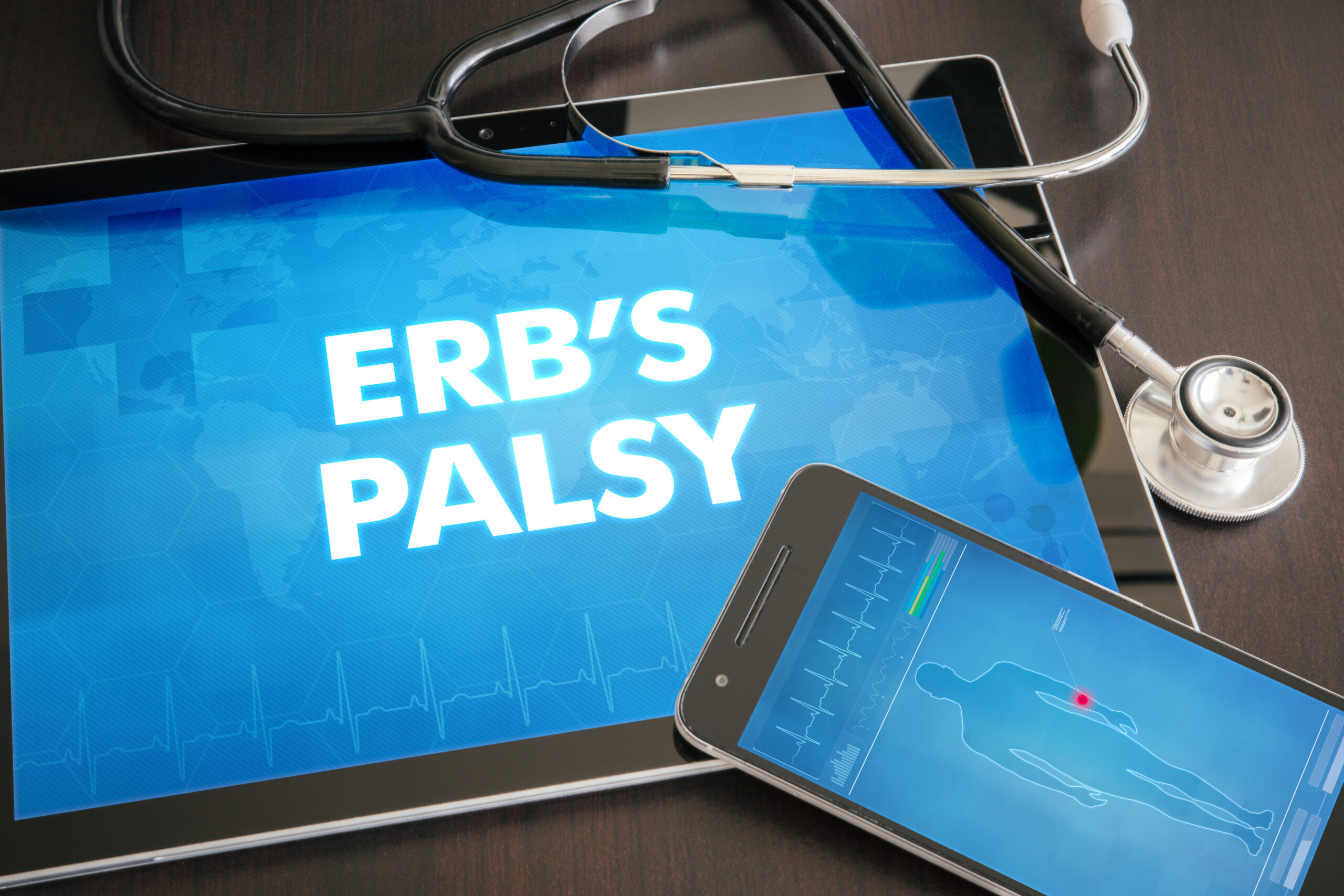 Erb's Palsy