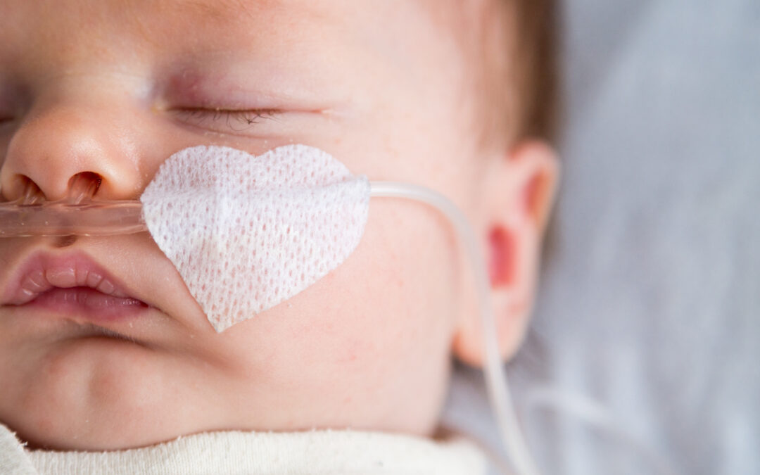 Lack of Oxygen (Asphyxia) During Birth