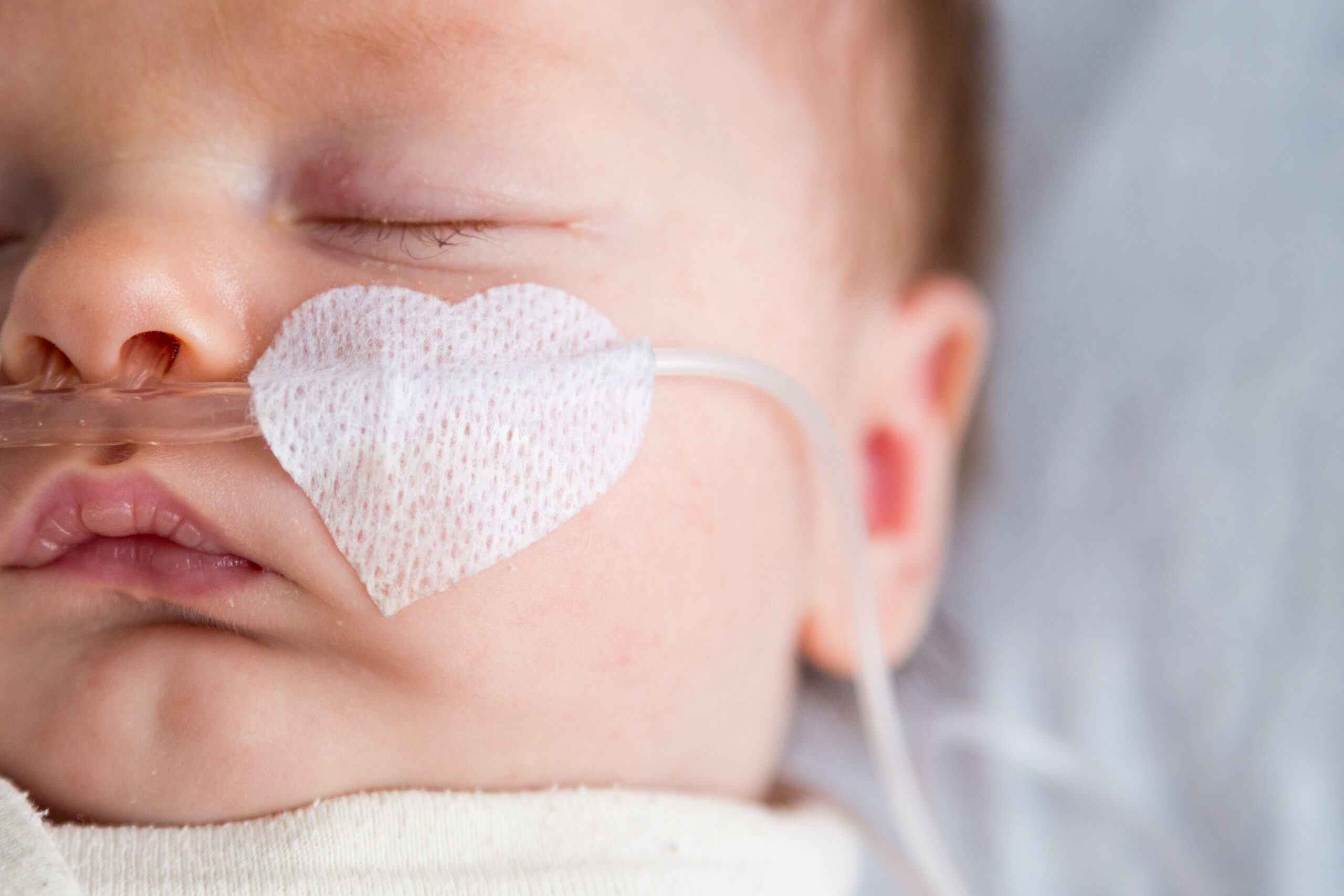 Baby with a breathing tube