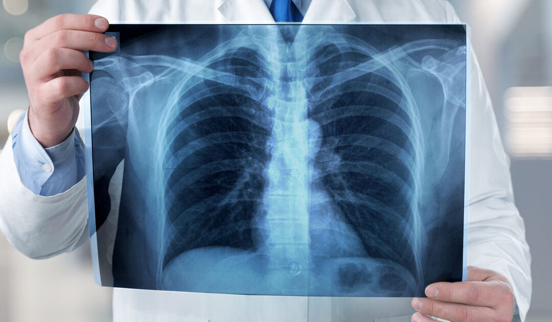 Central Kentucky Radiology Data Breach Class Action INVESTIGATION