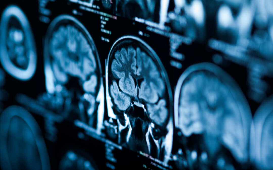 Northwest Radiologists, Inc. d/b/a Mount Baker Imaging Data Breach