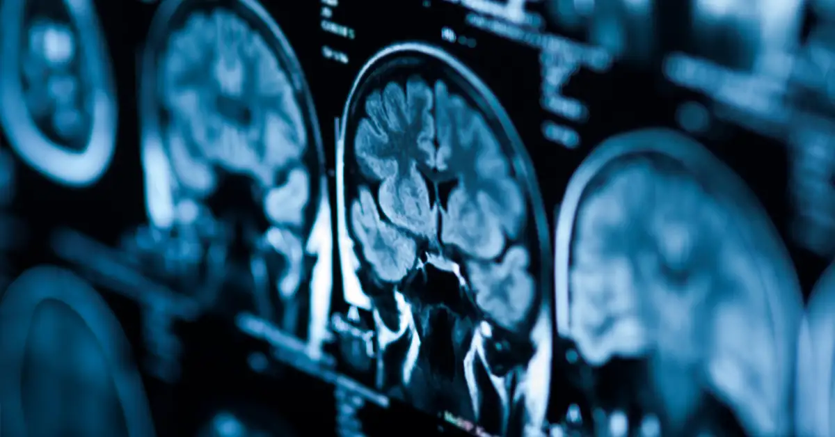 medical imaging result of scan