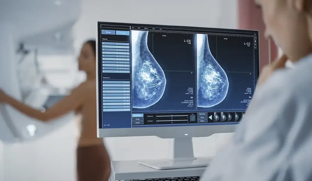 Onsite Mammography Faces Multiple Class Actions Over Patient Data Breach