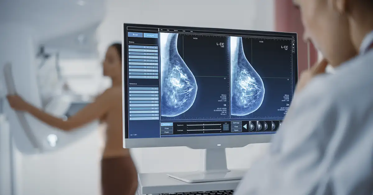 image of mammogram reading