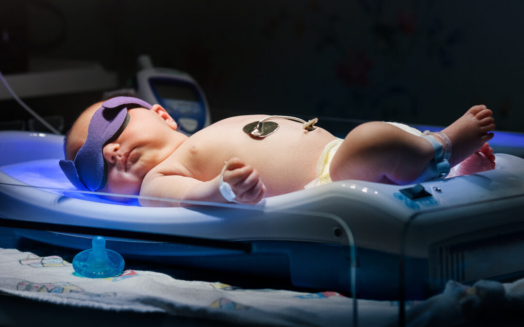 Neonatal Jaundice – Kernicterus Birth Injury