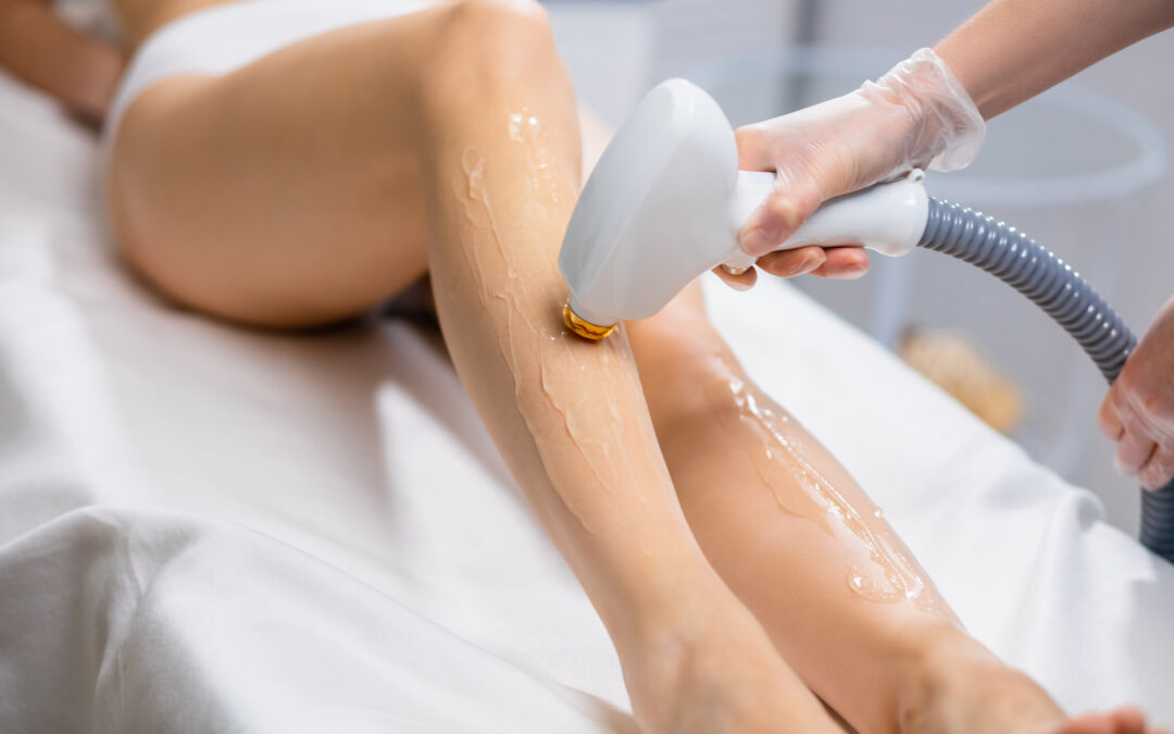 Did You Book a Laser Treatment with SEV Online?